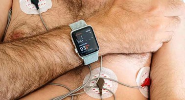 Die Apple Watch im Praxistest von Kardiologen